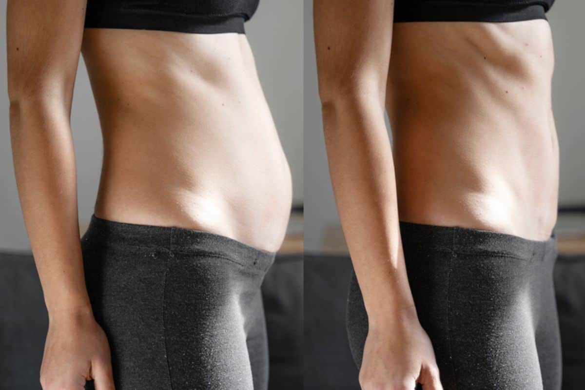 Post-Pregnancy: What Happens to Your Abdominal Muscles After Birth Slough