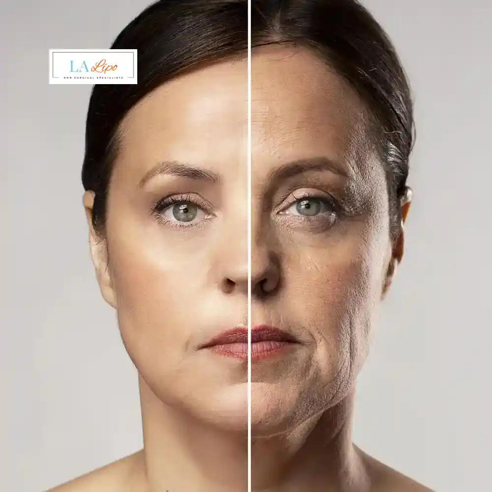 How Can You Tell If Non-Surgical Skin Tightening Is Right for You Slough?
