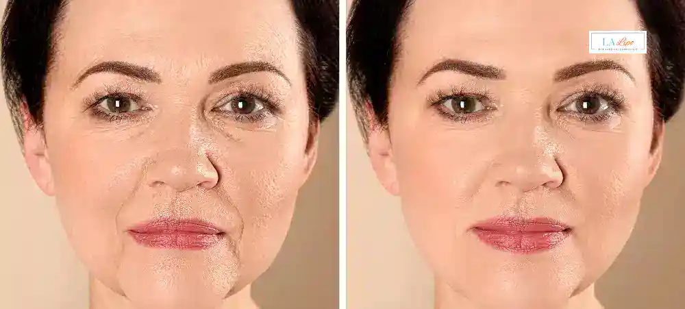 Why Aren’t My Skincare Products Making My Sagging Skin Look Firmer Slough?