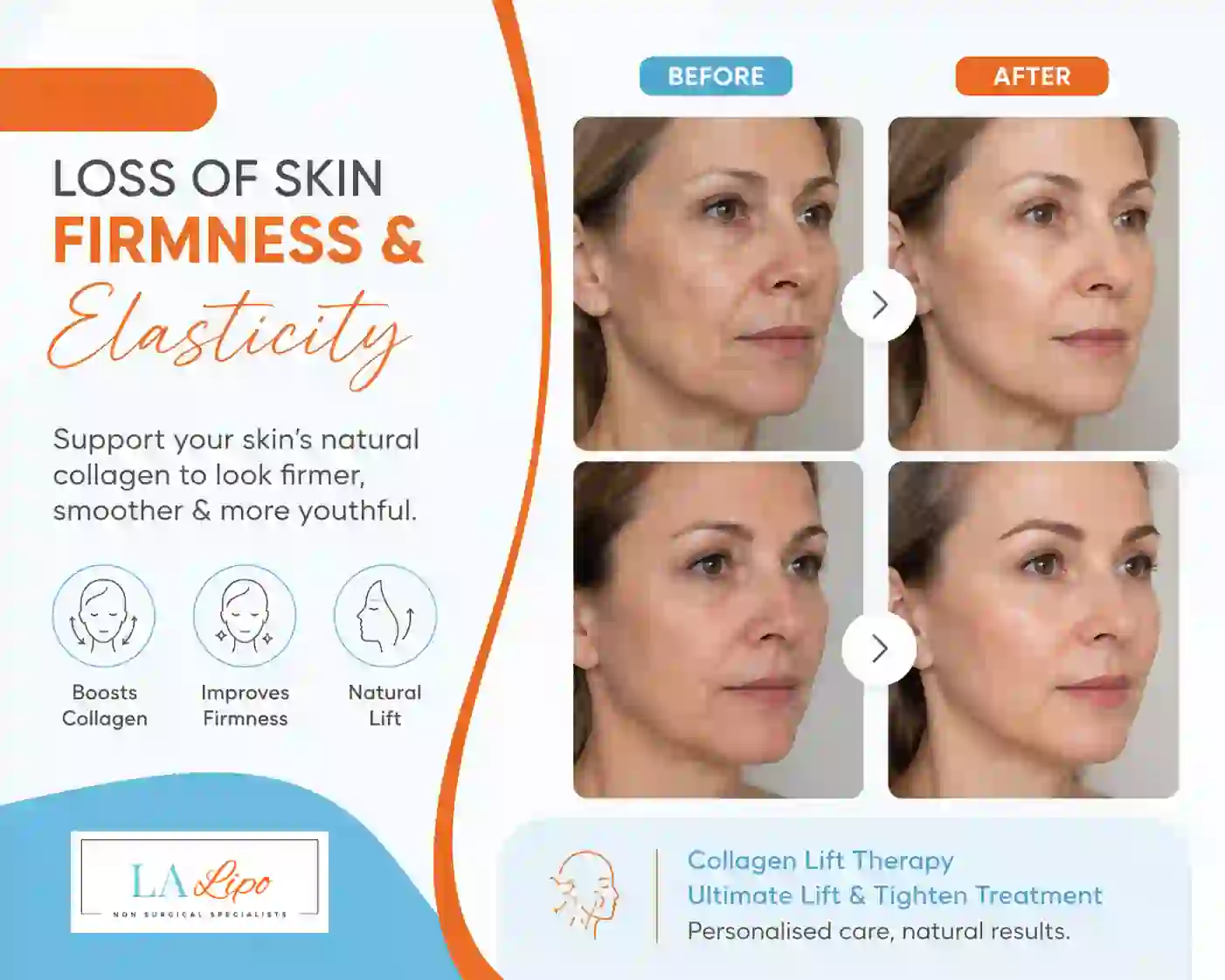 Sign #7: Loss of Skin Firmness and Elasticity Slough