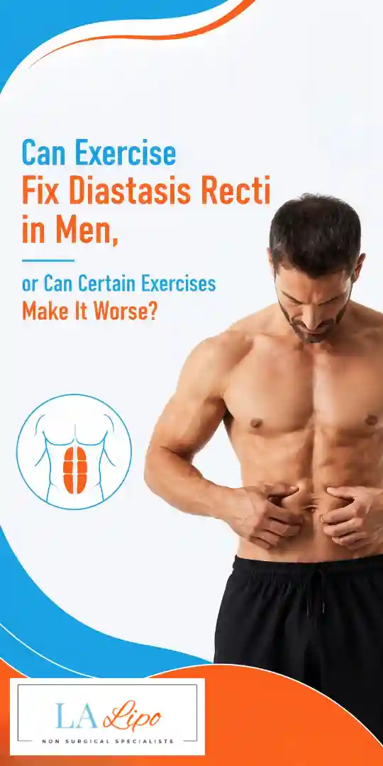 Can Exercise Fix Diastasis Recti in Men, or Can Certain Exercises Make It Worse Slough?